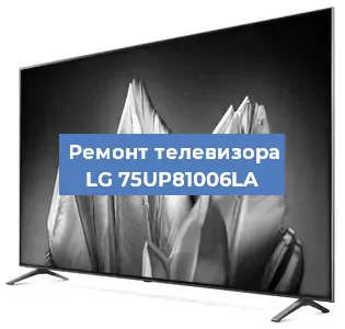 Замена шлейфа на телевизоре LG 75UP81006LA в Ижевске